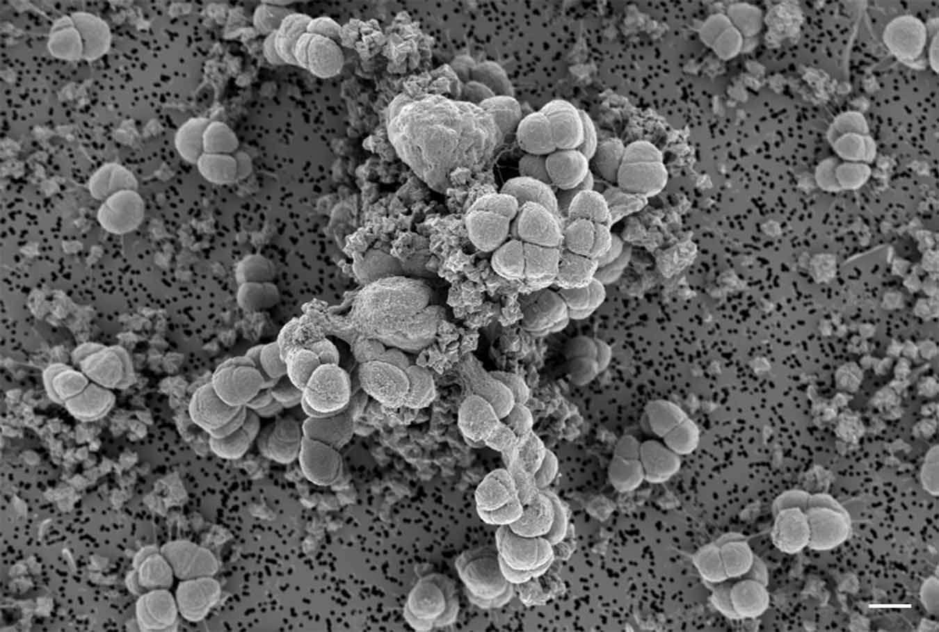 Methanosarcina